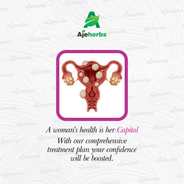 FIBROID TREATMENT